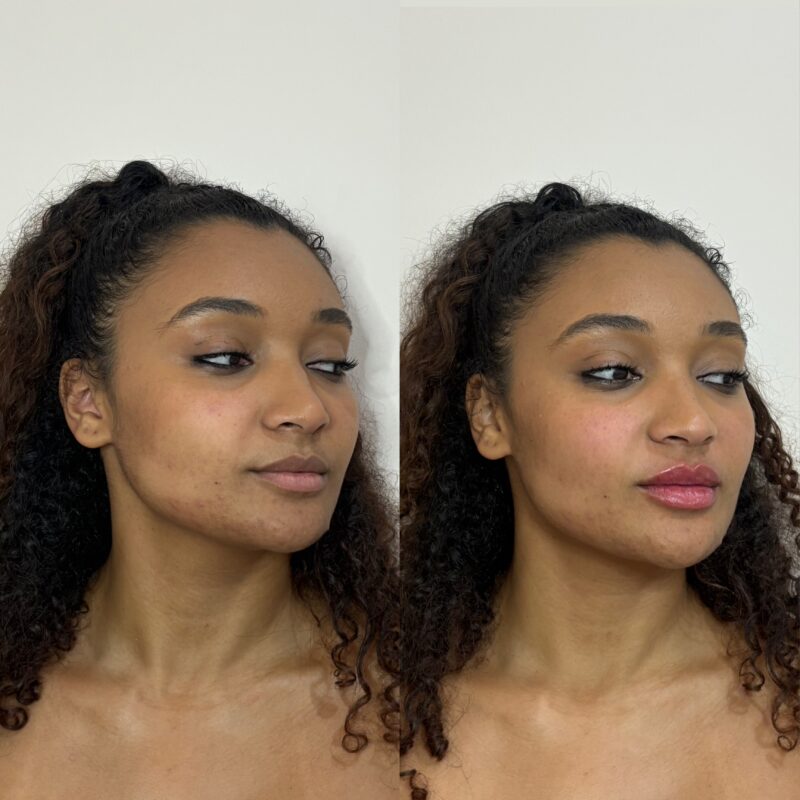 Bronzeamento Artificial no Campo Limpo - SP | Beauty Clinic Estética · Beauty Clinic Estética Avançada — Vila Prel, São Pa…